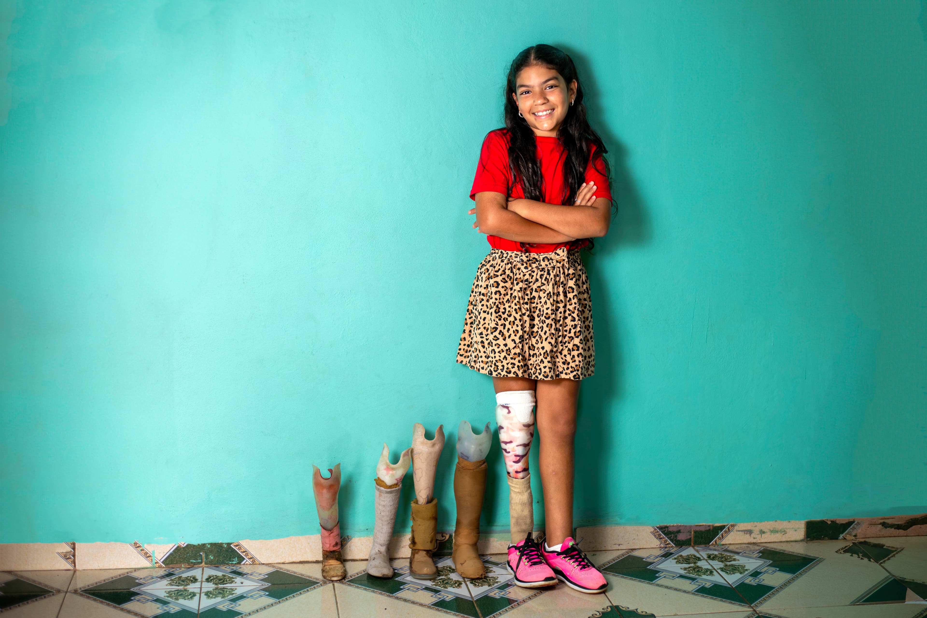 Connie stands beside her prosthetics